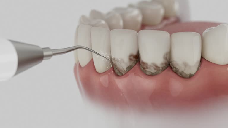 Trusted Invisalign Clear Aligners service in Riverside, MD - Dentist Open Now